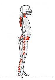 Un model de compensation postural suite à une césarienne