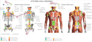 Système Axial proximal